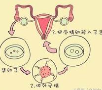 不孕不育在鞍山市做试管的费用有多少？一文告诉你做三代试管建档的流程有哪些